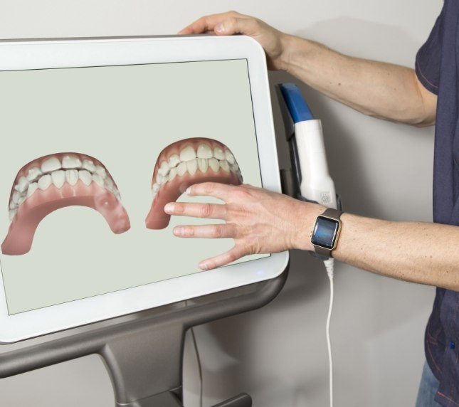 Dentist looking at scan taken with iTero digital scanner