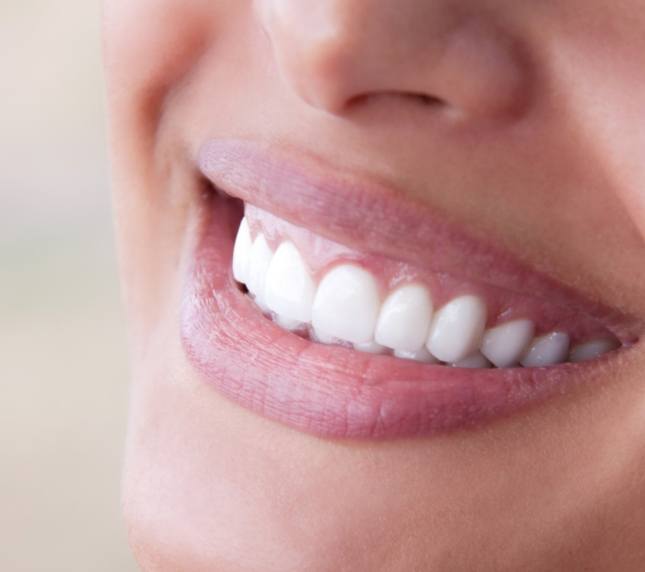 Close up of teeth after a smile makeover