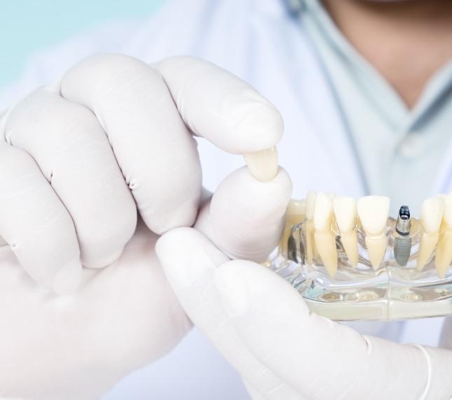 Dentist holding crown and model of dental implants