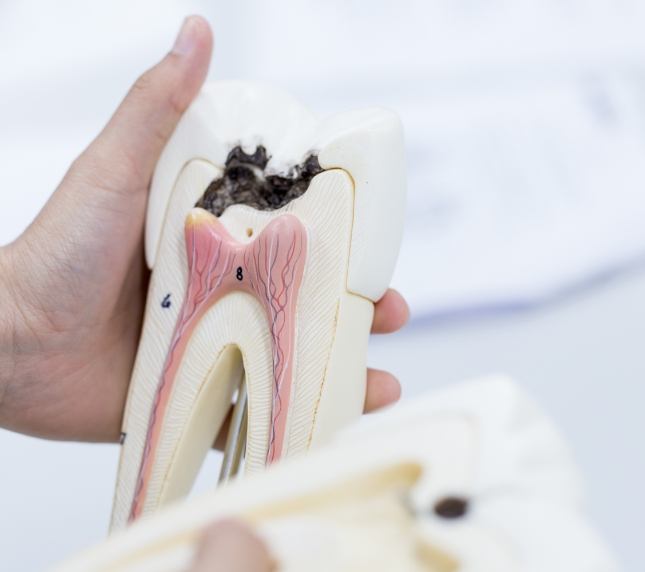 Looking at model of an infected tooth