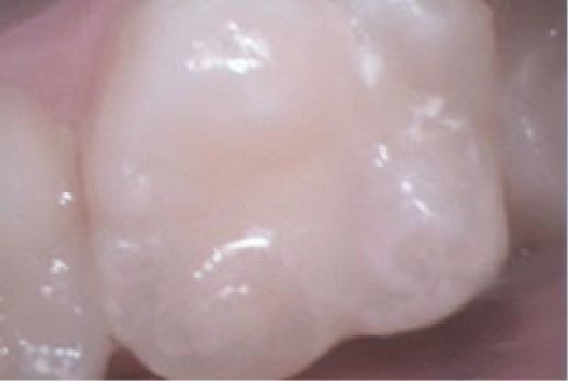 Close up of white tooth